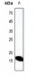 Anti-Defensin alpha 3 Antibody